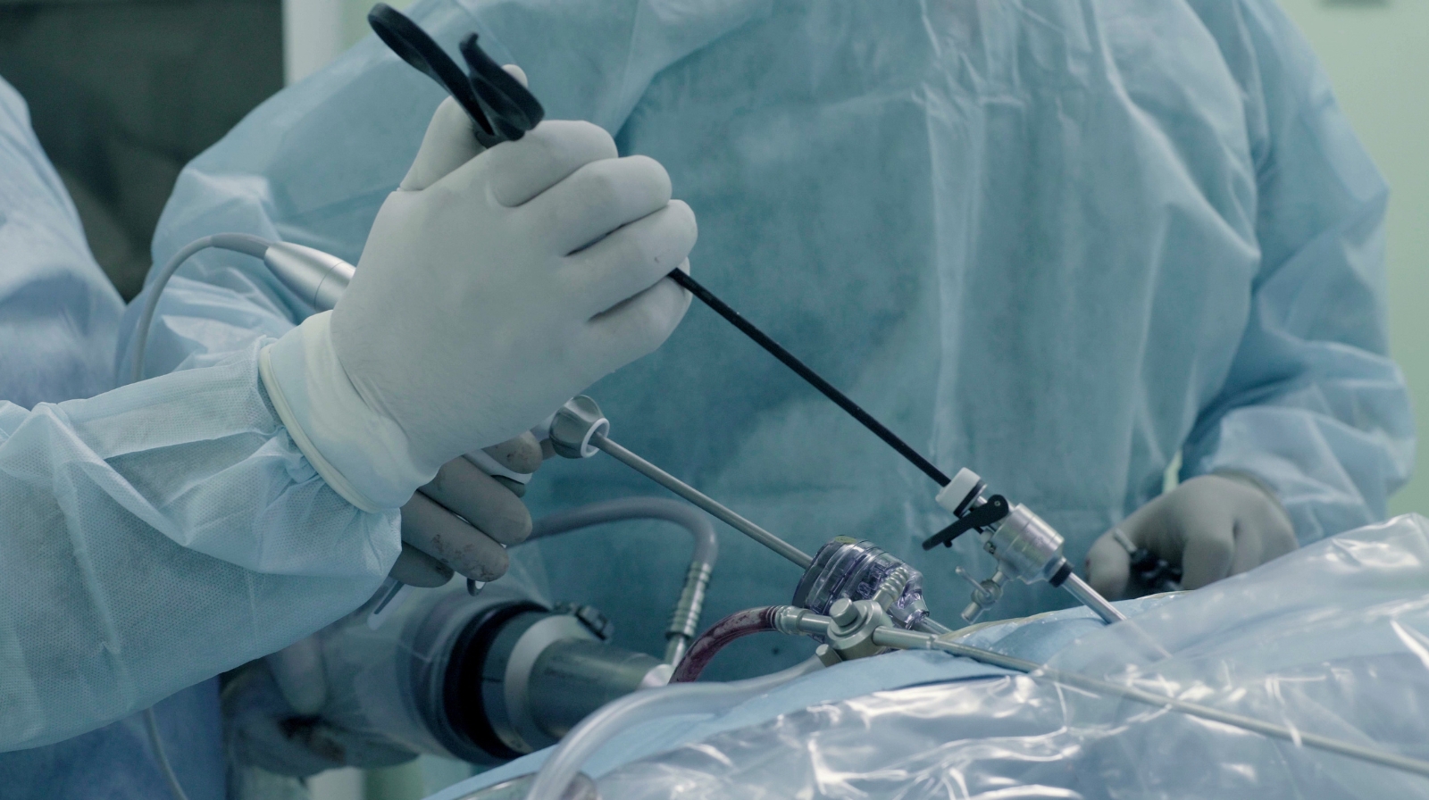 Laparoscopic Surgery